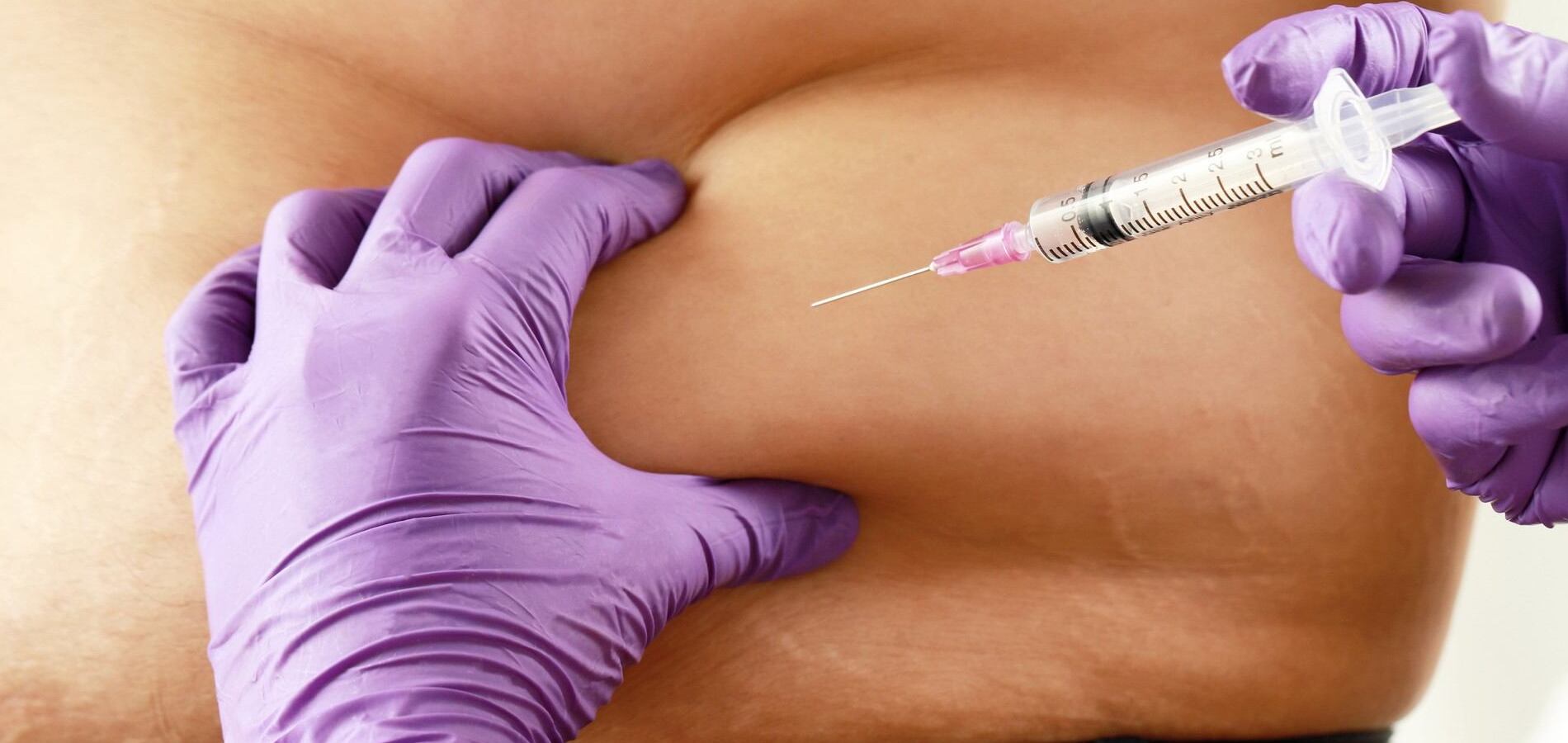 Lipotropic Injections in Upper Marlboro, MD